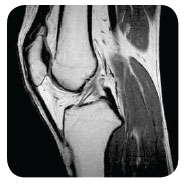 Understanding your knee