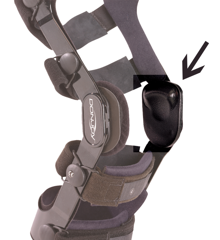 DonJoy Supra Condylar Pad