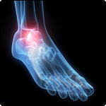 Ankle