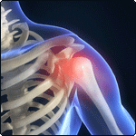 Shoulder
