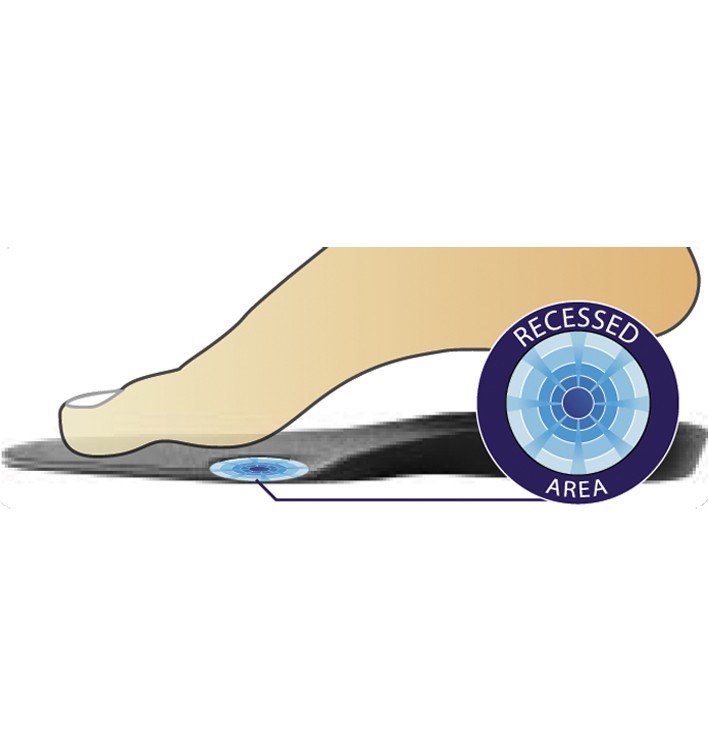 Donjoy arch rival orthotic inserts clearance