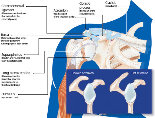 shoulder impingement syndrome