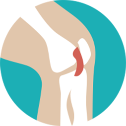 Knee Illustration