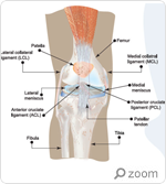 ACL Injury